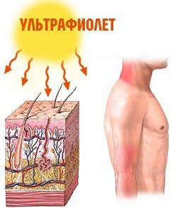 Противопоказания к лечению