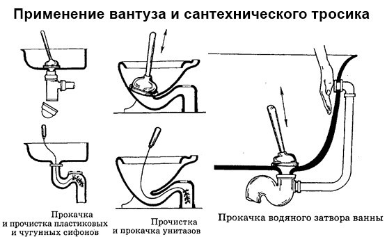 Что можно использовать вместо вантуза