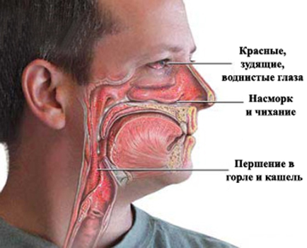 Симптомы аллергии